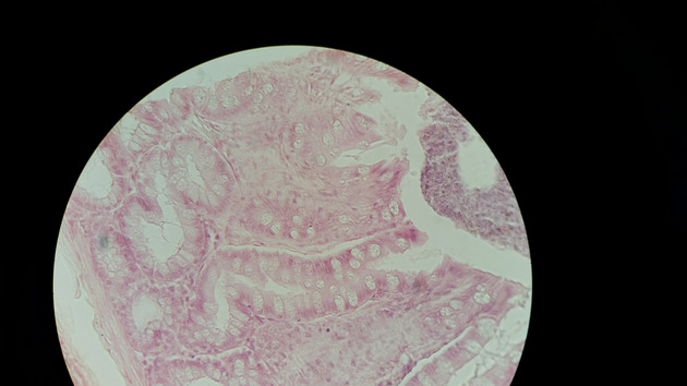Colon Slides - Colon 004 400X